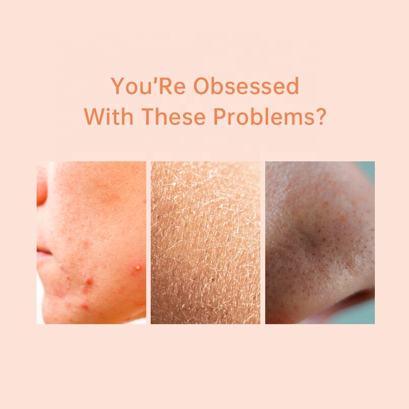 Facial Acne Serum Manufacturer - Best Selling Organic Vegan Whitening