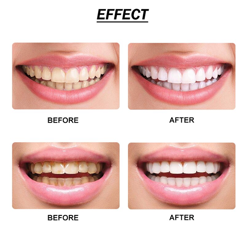 Tooth Powder Manufacturer - OEM Natural Charcoal Whitening Oral Care