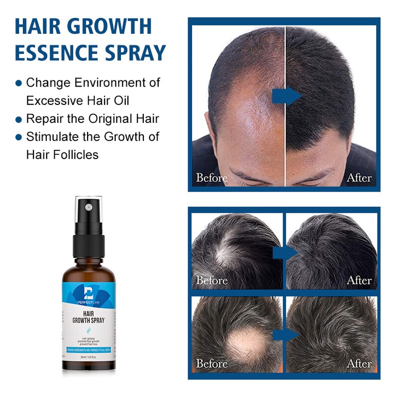 Hair Growth Serum Manufacturer - Hot Sale Prevent Hair Loss Rice Serum
