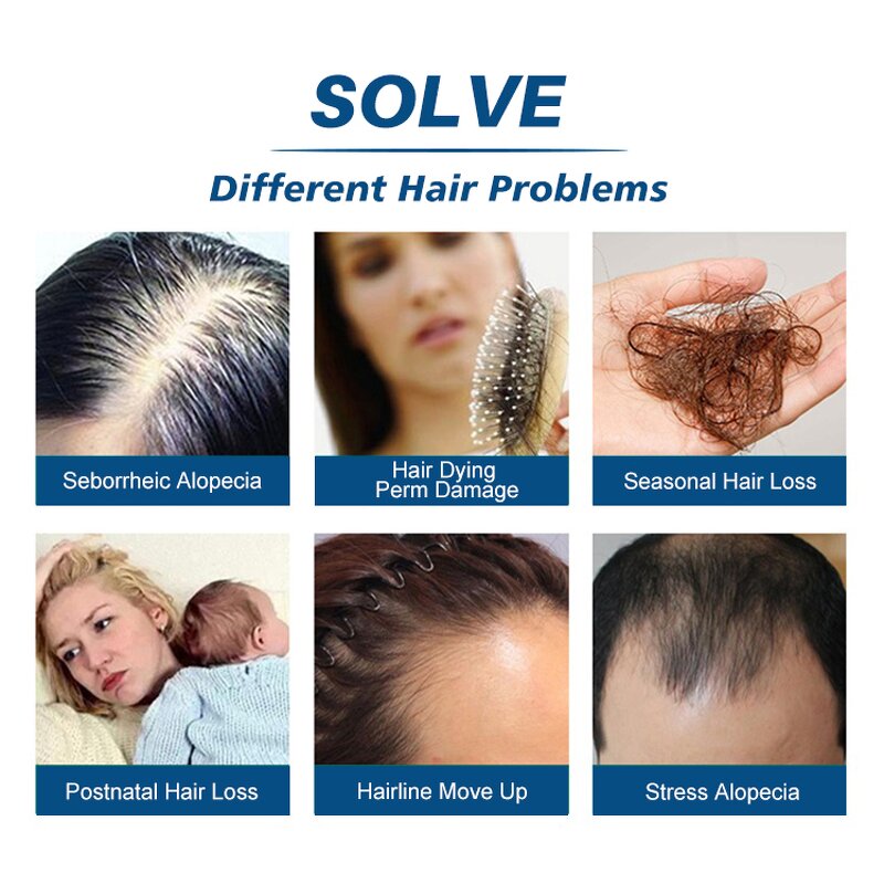 Hair Growth Serum Manufacturer - Hot Sale Prevent Hair Loss Rice Serum