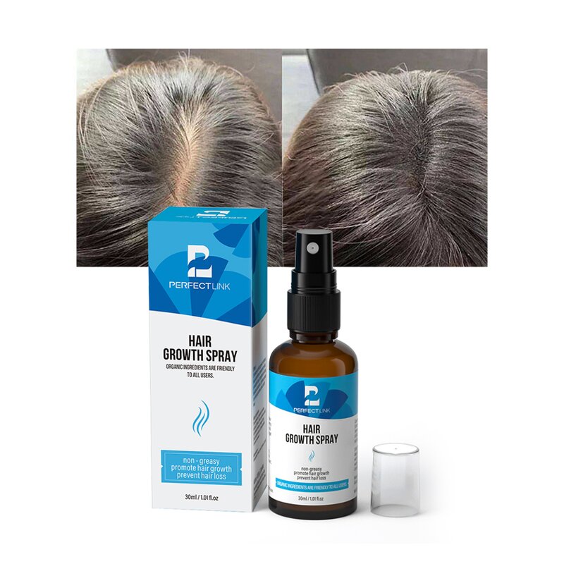 Hair Growth Serum Manufacturer - Hot Sale Prevent Hair Loss Rice Serum
