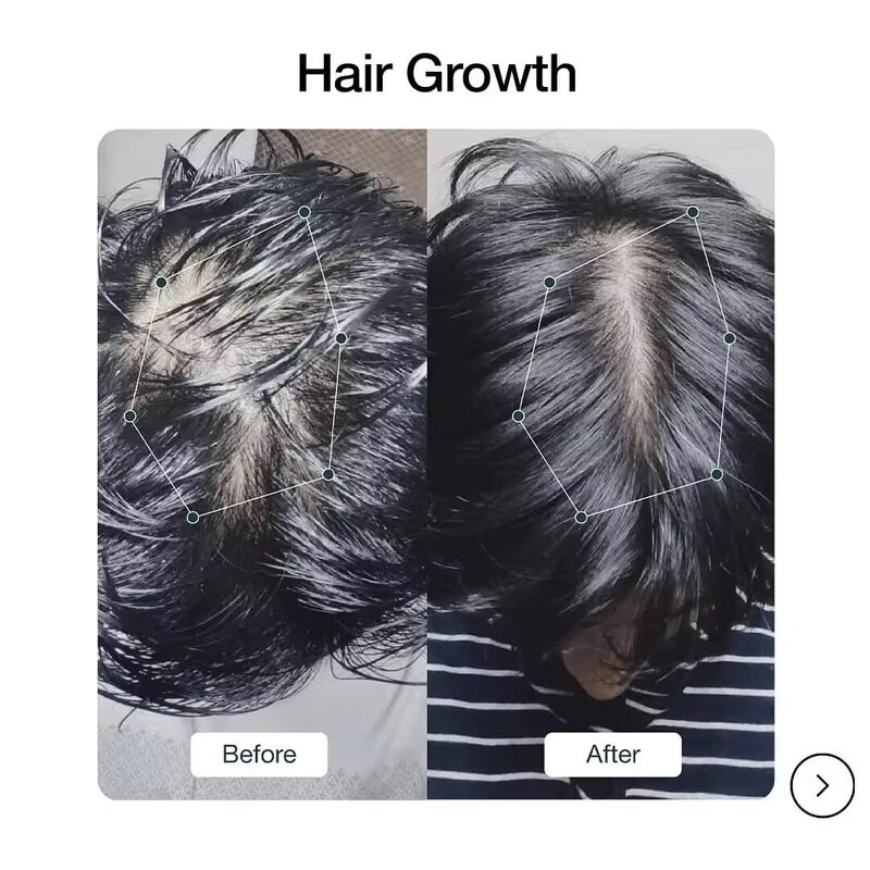 Biotin Hair Shampoo Manufacturer - Sulfate Free Paraben Free