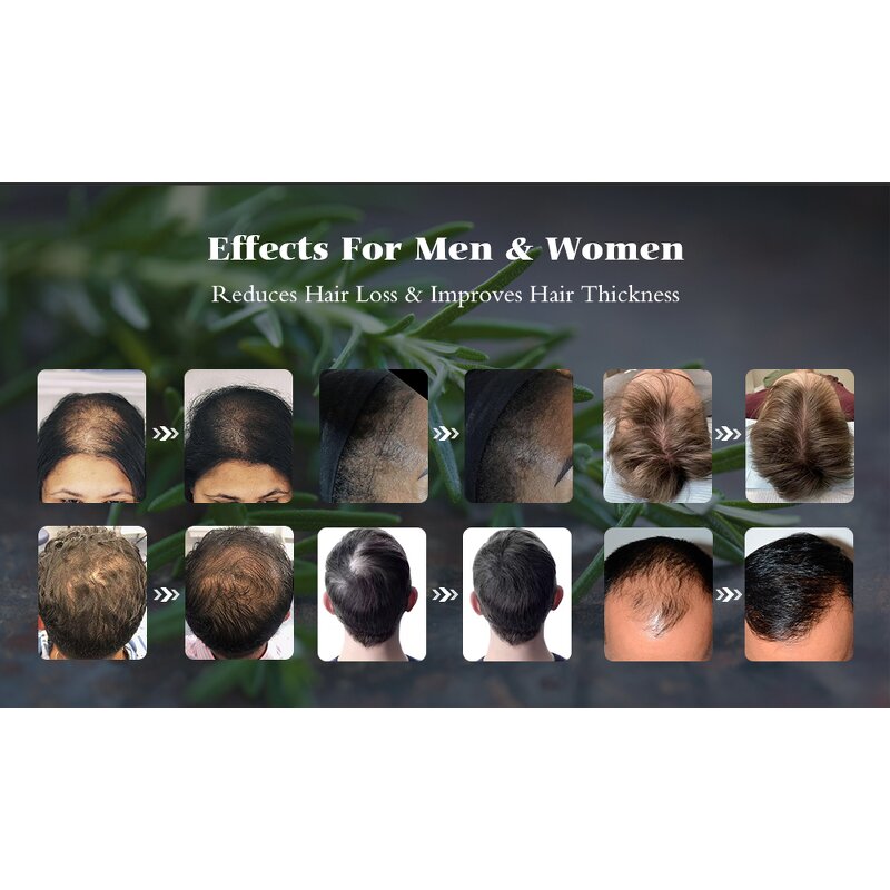 Anti-Hair Loss Shampoo Set Manufacturer - For Healthy Hair