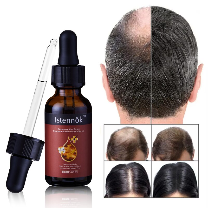 Hair Growth Oil Manufacturer - For African Alopecia