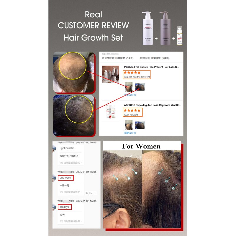 Hair Growth Shampoo Set Supplier - Custom Logo OEM