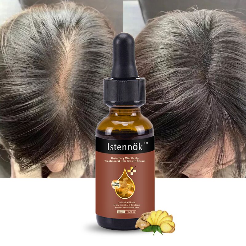 Scalp Hair Strengthen Oil Manufacturer - Biotin Infused