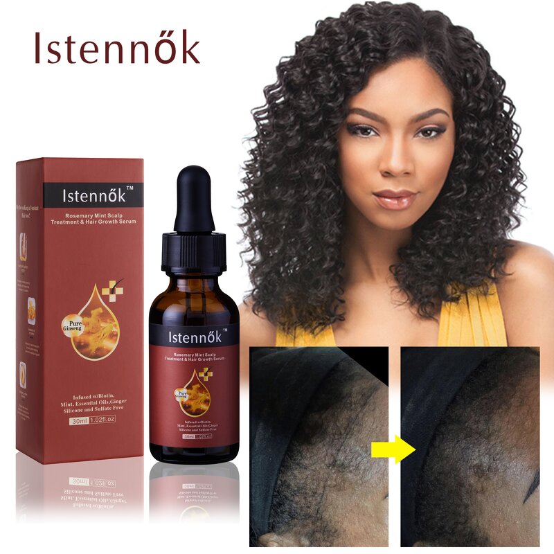 Anti Hair Loss Serum Manufacturer - Vitamin C & Ginger