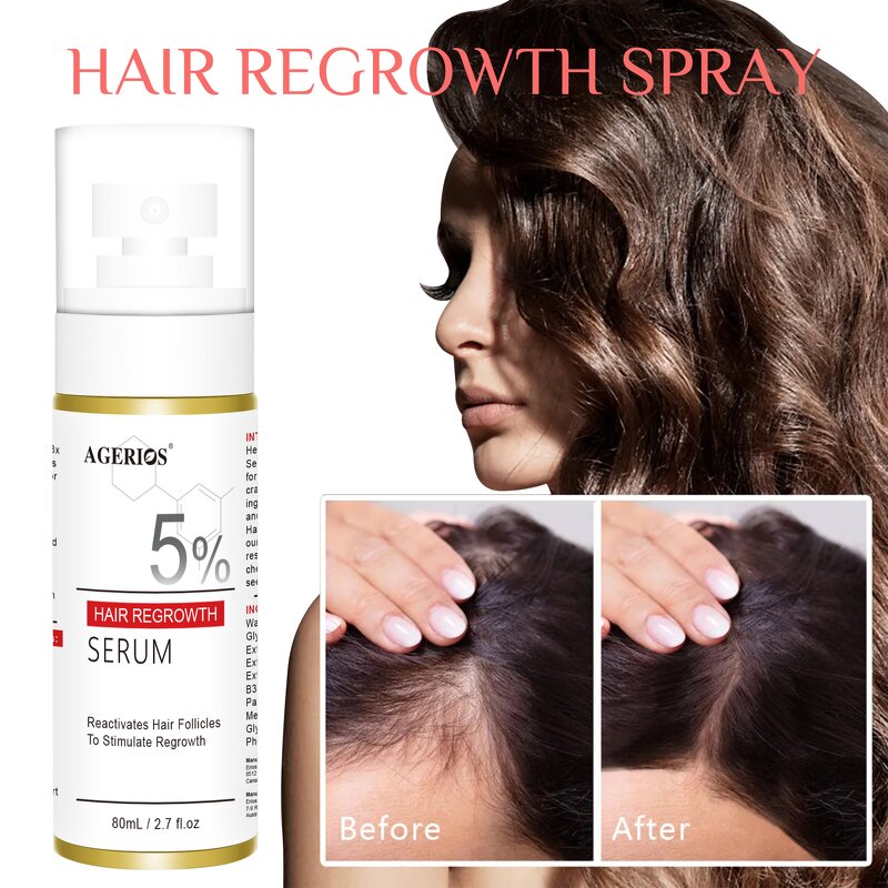 5% Hair Regrowth Spray Factory - OEM/ODM Wholesale