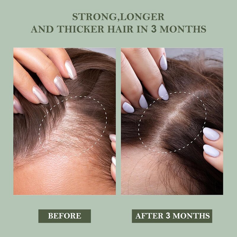 2-in-1 Shampoo Conditioner Manufacturer - Peppermint for Hair Growth