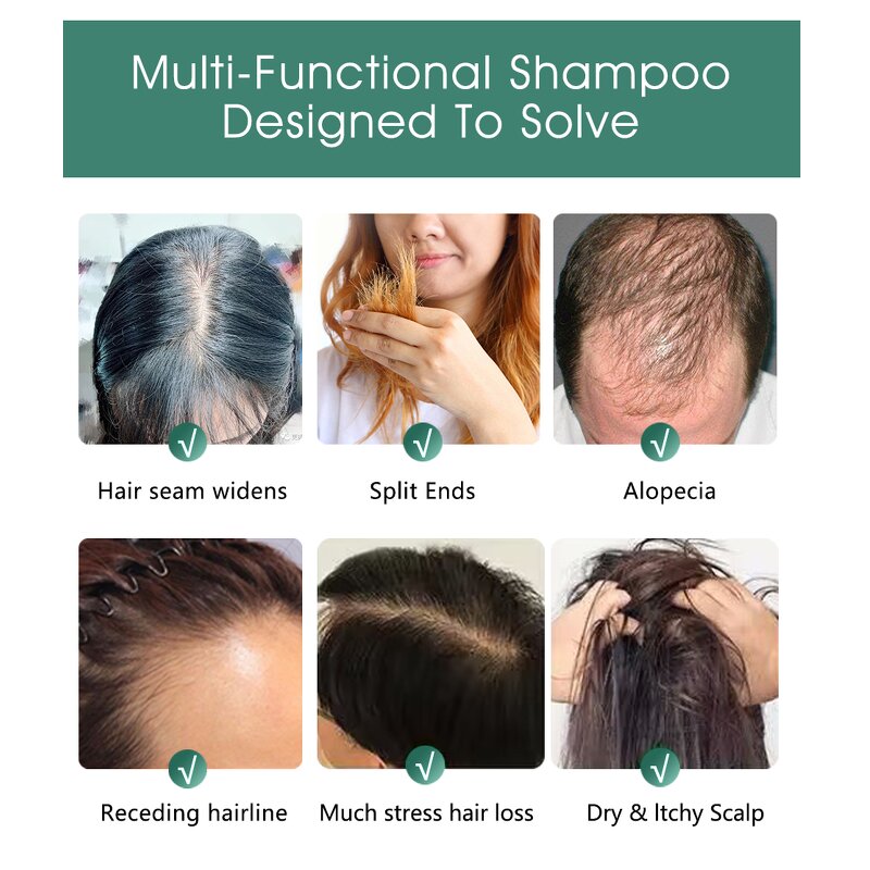 Shea Butter Shampoo Manufacturer - Prevent Hair Loss