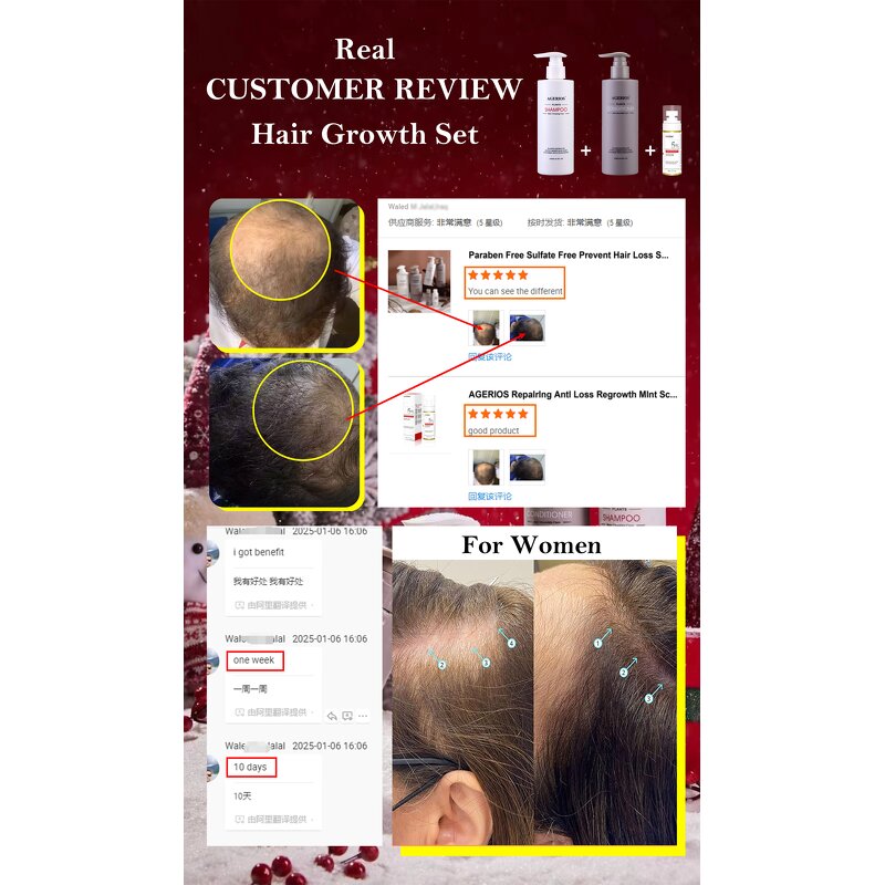 Redensyl Hair Serum Manufacturer - Bulk OEM/ODM Private Label