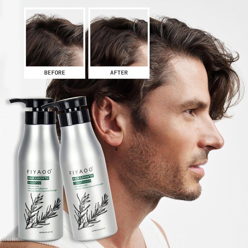 2-in-1 Shampoo Conditioner Manufacturer - Peppermint for Hair Growth