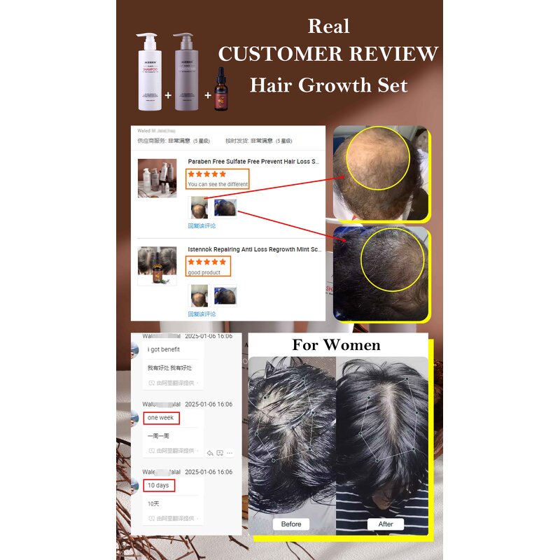Ginger Anti-Hair Loss Shampoo Factory - Bulk Wholesale