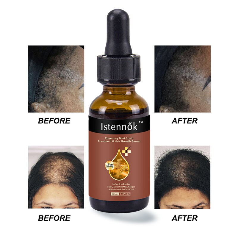 Scalp Hair Strengthen Oil Manufacturer - Biotin Infused