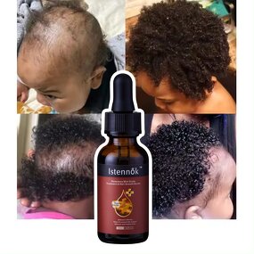 Hair Growth Oil Manufacturer - For African Alopecia