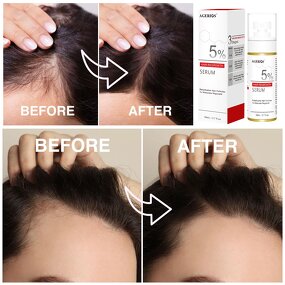 Plant-Based Hair Growth Spray Supplier - OEM/ODM Custom Formula