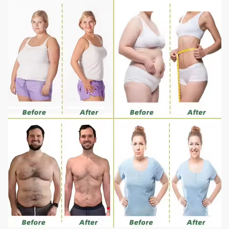 Liver Support Capsules Factory - OEM Metabolism Boost with TMG NAC Milk Thistle