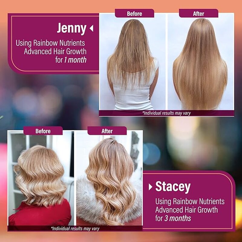 Hair Loss Capsules Supplier - Biotin Saw Palmetto for Healthy Hair Growth Adults