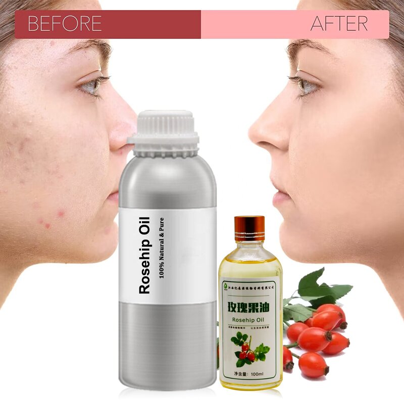 Rosehip Seed Oil Supplier - Bulk for Face