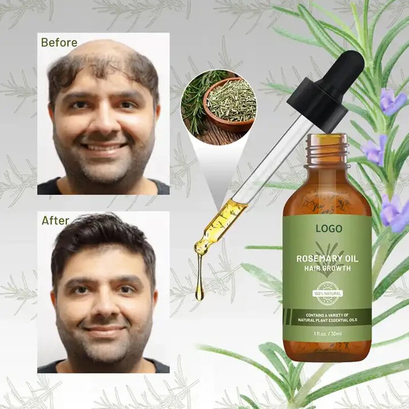 Rosemary Hair Oil Manufacturer - Private Label 100% Natural Formula Nourishing for Hair Loss