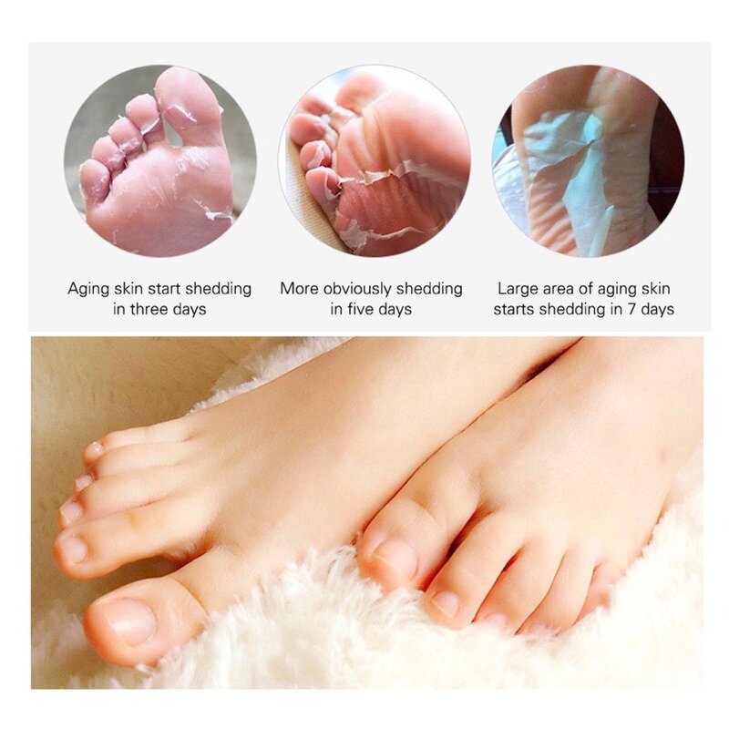 Foot Peel Mask Supplier - Wholesale Callus Remover for Men Women