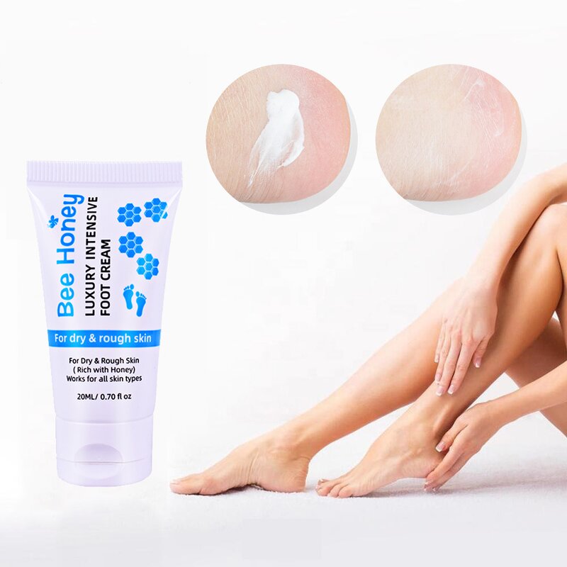Foot Cream Supplier - Hot Selling Honey Anti-fungal Dead Skin