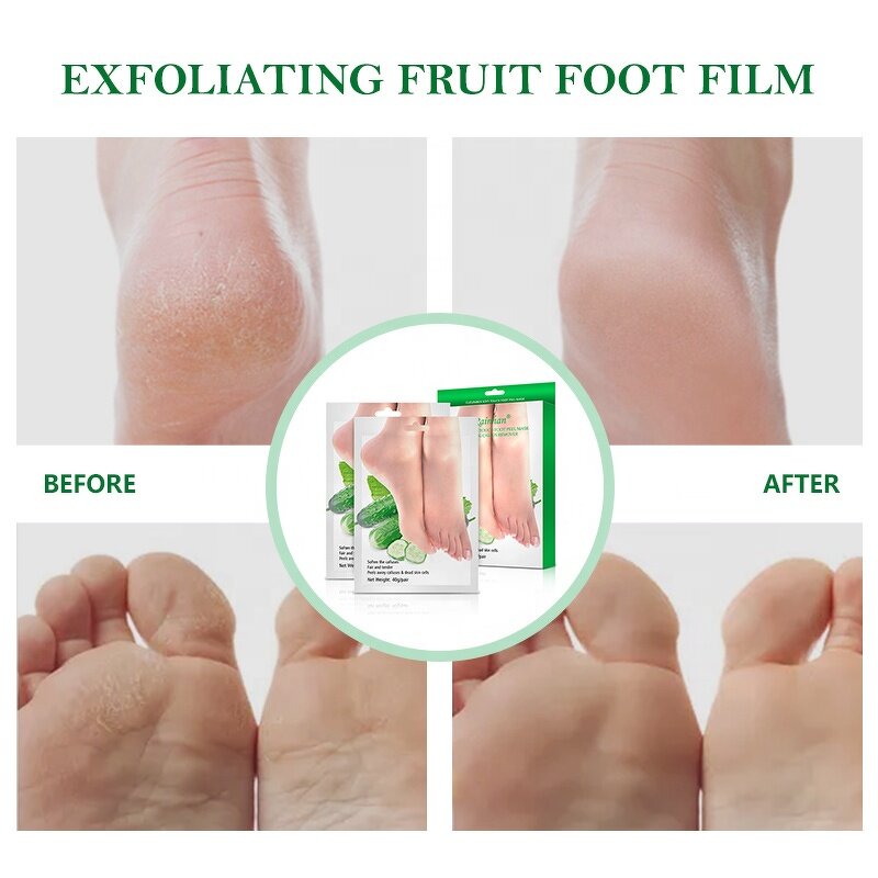 Foot Peel Mask Supplier - Wholesale Natural Organic Olive Oil