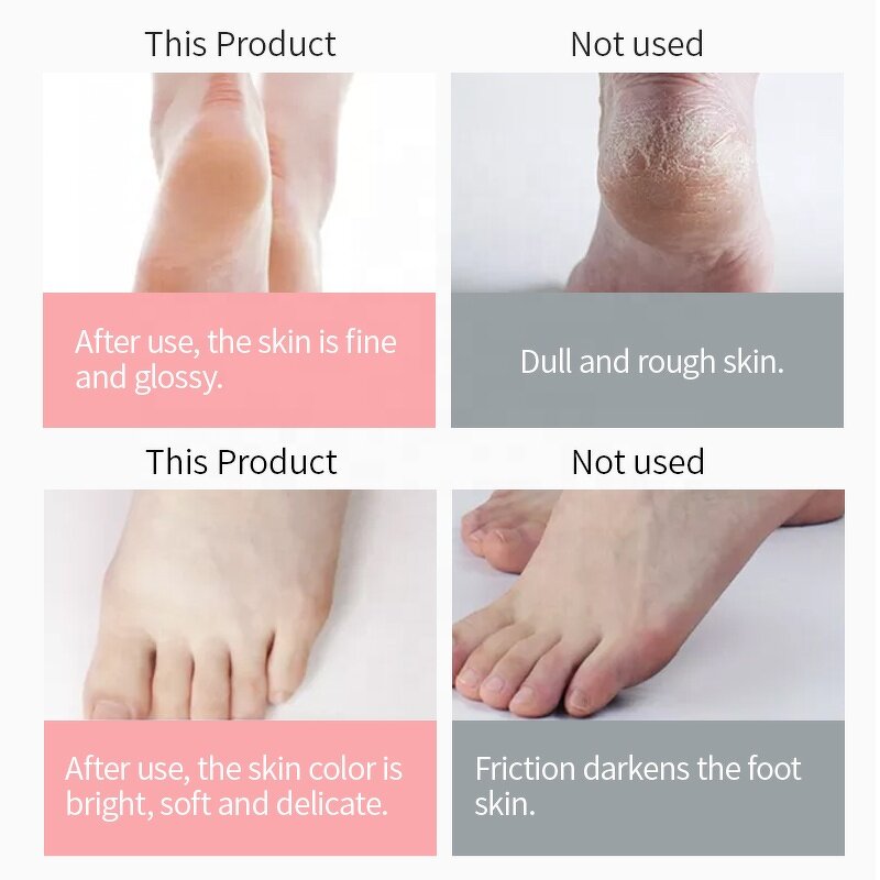 Foot Cream Factory - OEM Private Label 15% Urea Luxury Moisturizing