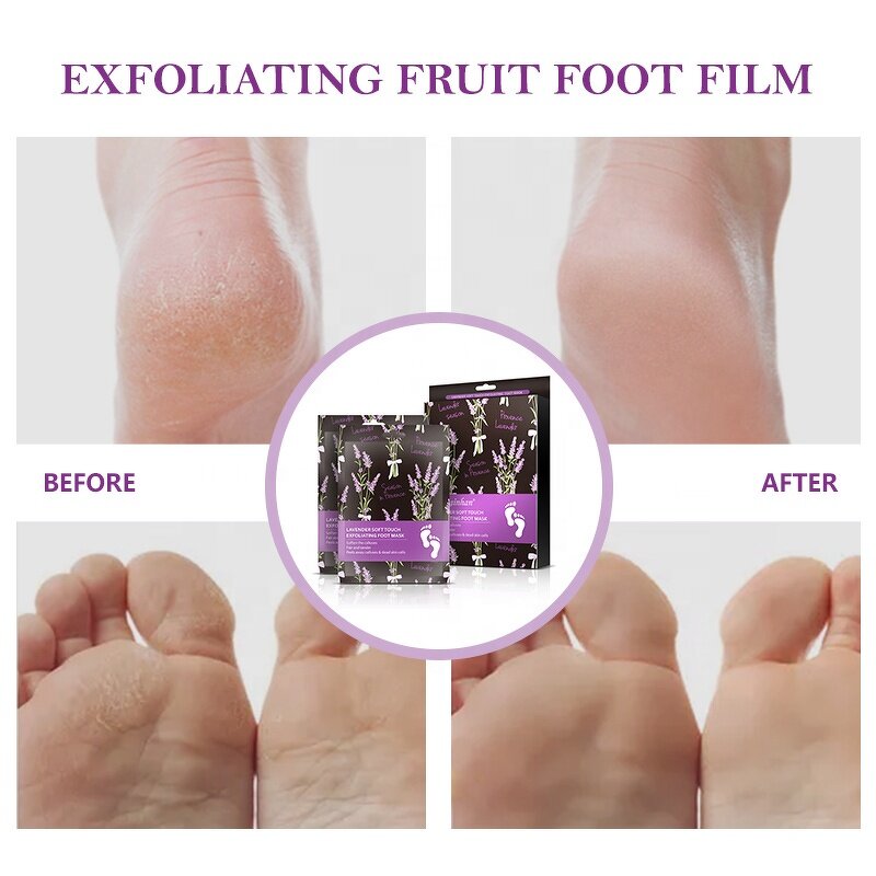 Foot Peel Mask Manufacturer - Custom Natural Organic Lavender