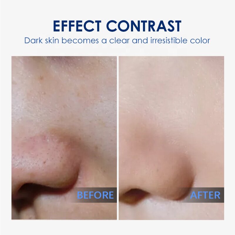 Wrinkle Cream Supplier - Skin Tightening Remover Fine Lines Firming