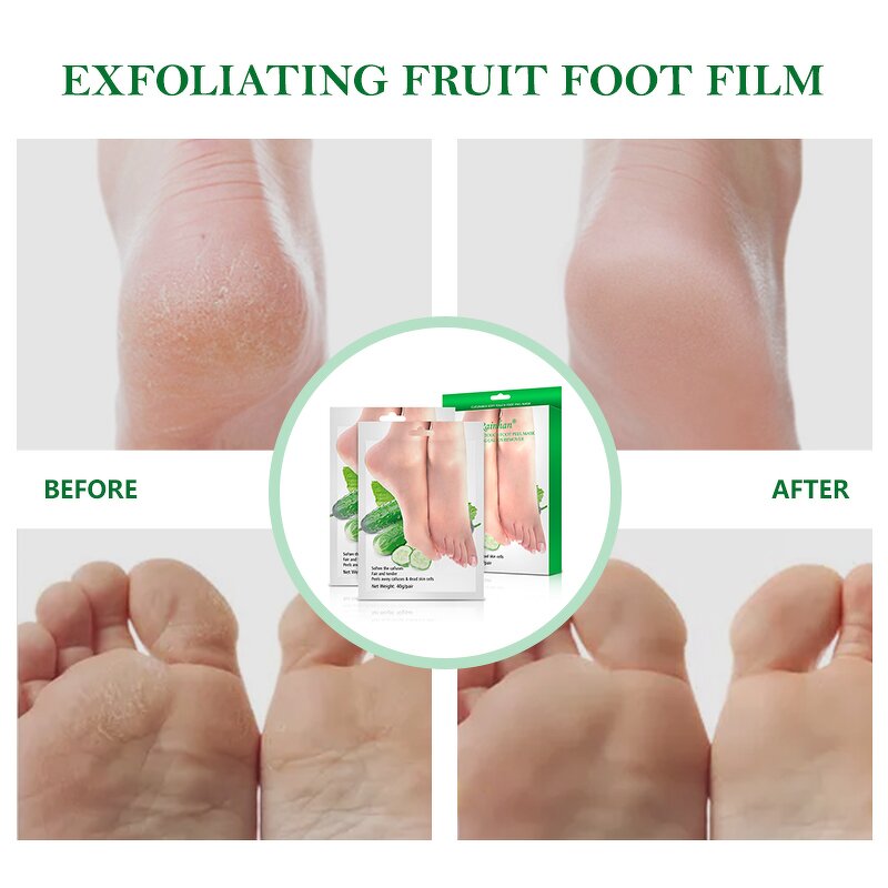 Foot Mask Factory - Wholesale Hot Sale Cucumber Exfoliating