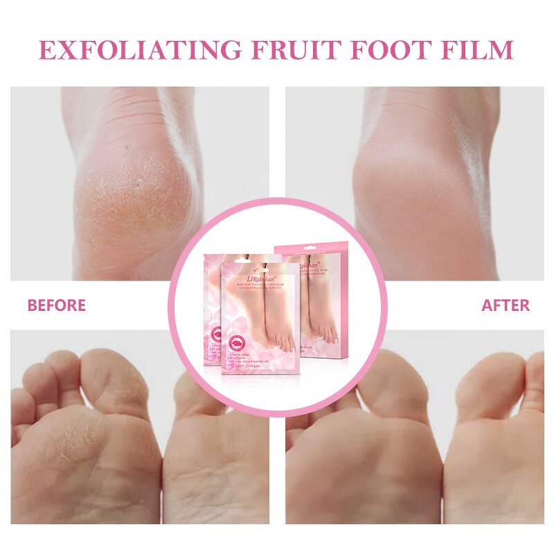 Foot Peel Mask Manufacturer - Custom Natural Organic Pink Rose