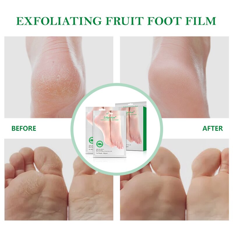 Foot Peel Mask Supplier - Private Label Korea Exfoliating Foot Care