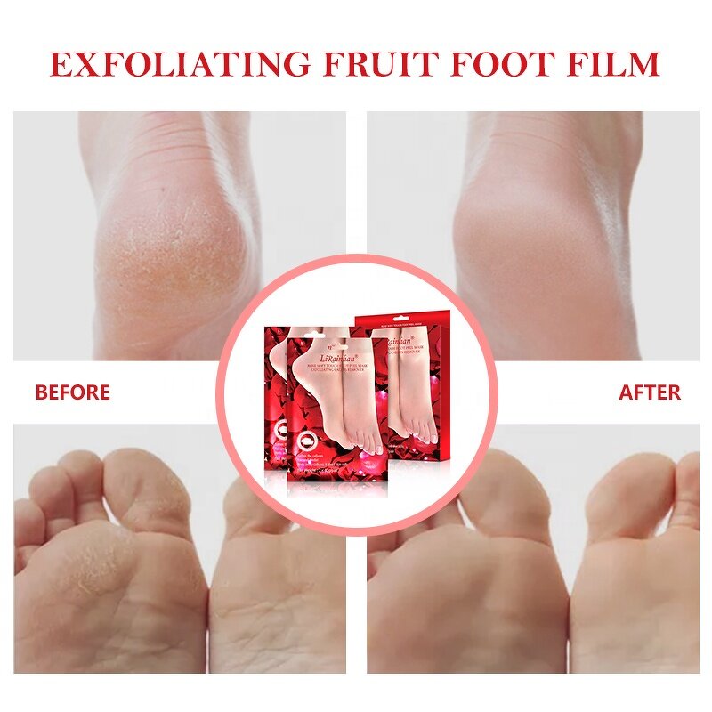Foot Peel Mask Supplier - Red Rose Exfoliating Hydrating Sheet