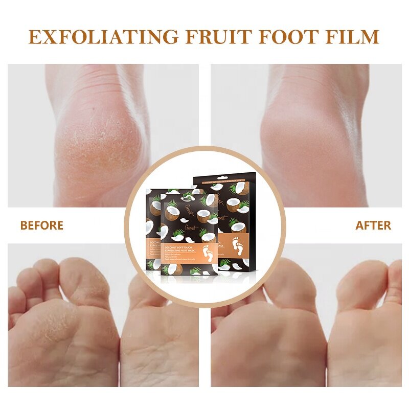 Foot Peel Mask Supplier - Custom Natural Organic Coconut Oil