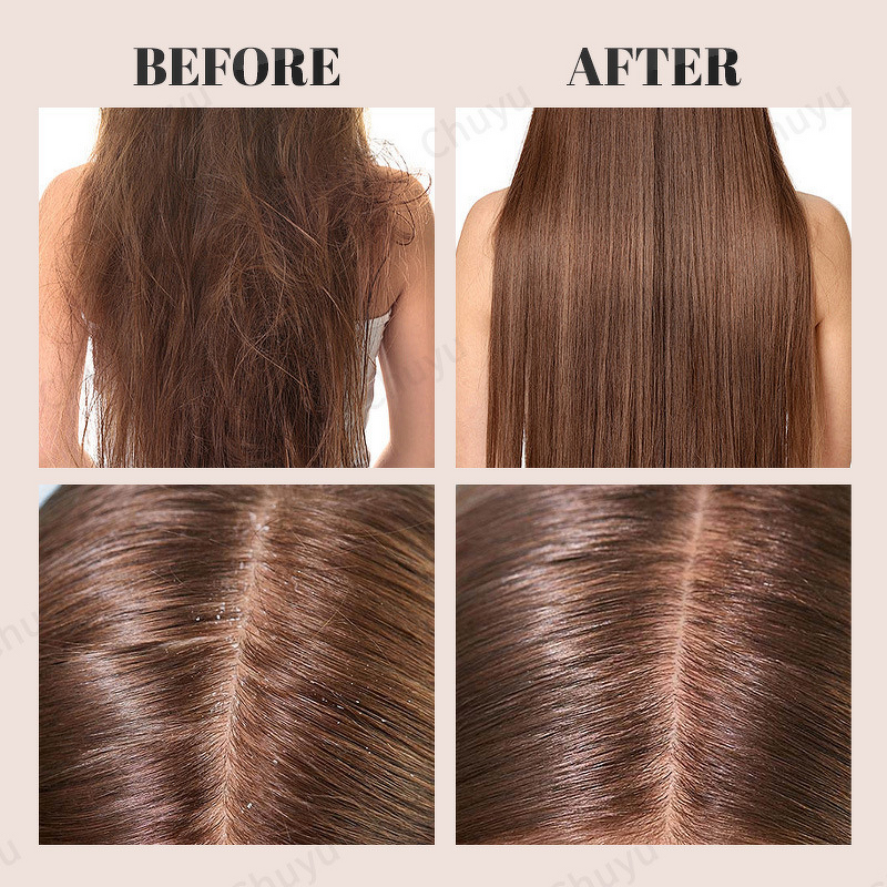 Shampoo Set Factory - Private Label Sulfate-free Anti-dandruff Argan Oil