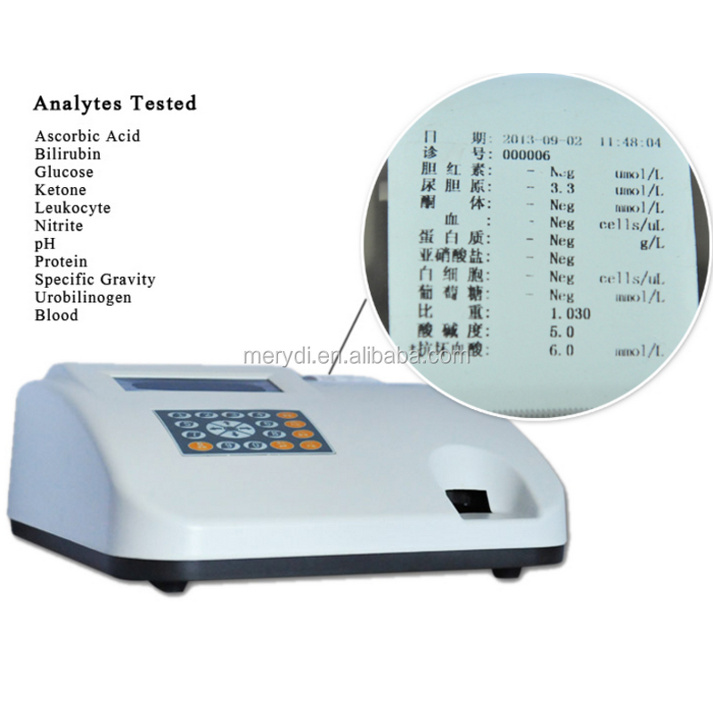 Urine Analyzer Factory - MERYDI W-200B Automatic Urine Analyzer