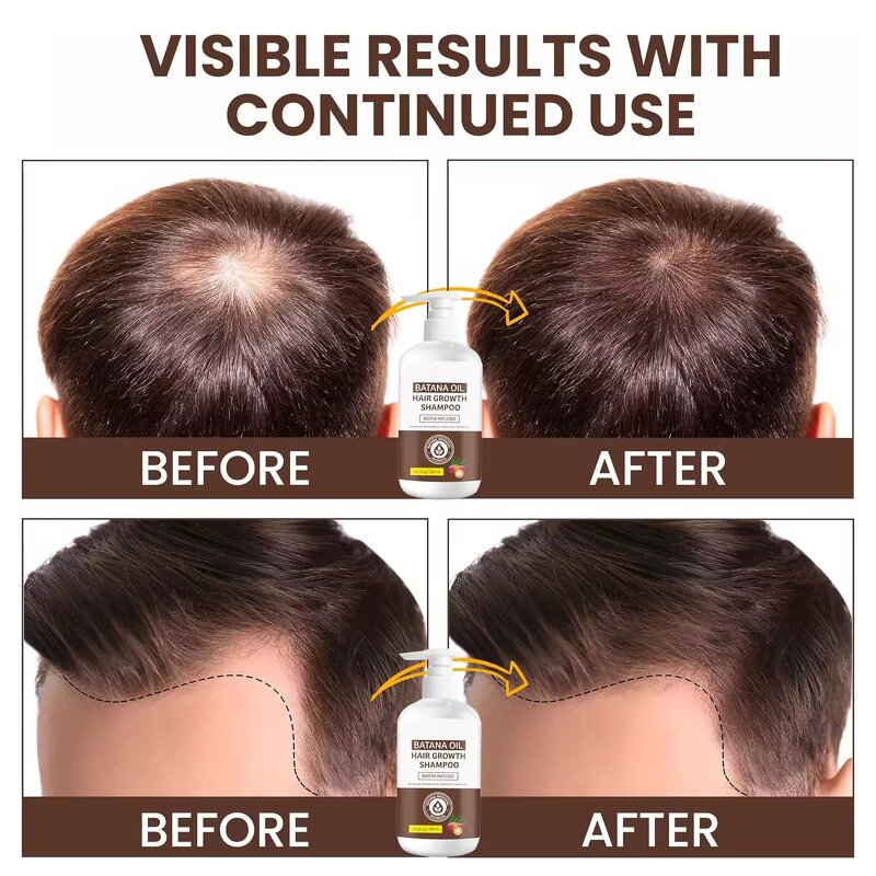 Batana Oil Manufacturer - Organic Raw for Hair Growth Regrowth