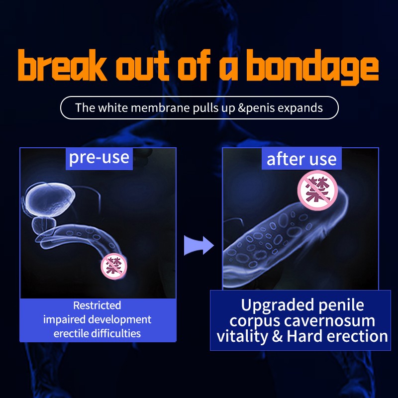 CokeLife Wholesale 25g Wake up Penis Erectile Sexual Glide Penile Epidermis Cream Penis Size Breakthrough Gel for Men