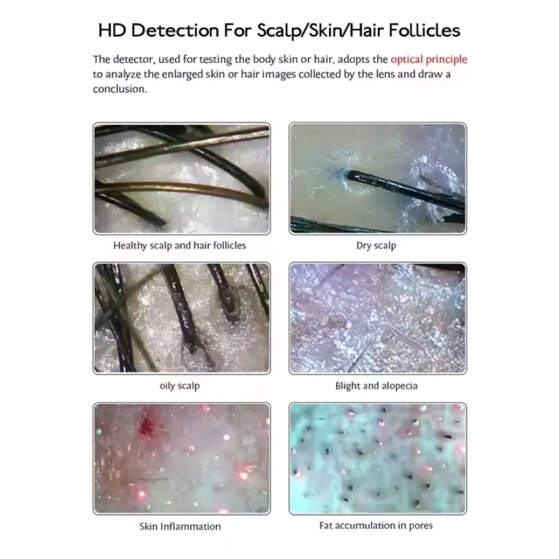 Kisen Skin and Scalp Hair Analysis Machine Hair Follicles Scalp Scanner Detector Hair Analyze 110V/220V