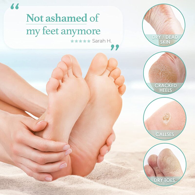 Foot Peel Mask Supplier - Natural Safe Botanical Extracts