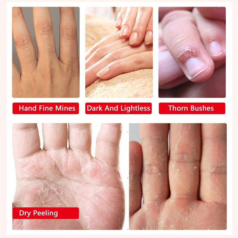 Hand Mask Supplier - Moisturizing Glove Remove Dead Skin