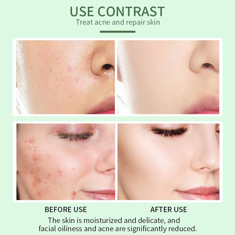 Serum Manufacturer - Vitamin B5 & C Pure Natural Antioxidant