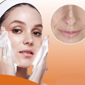 Bar Soap Supplier - Handmade with Curcuma Kojic Acid Face Cleansing