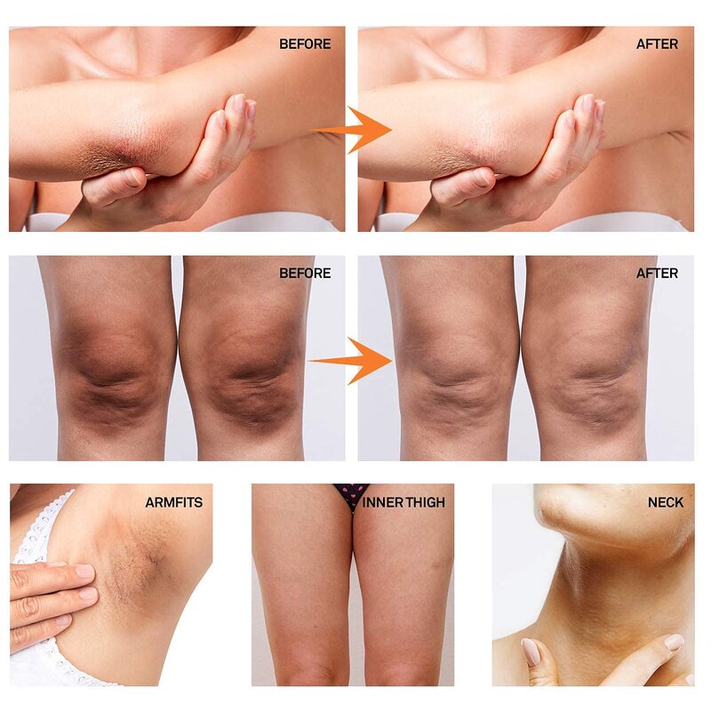 Underarm Whitening Supplier - Natural Organic Fast Instant Private