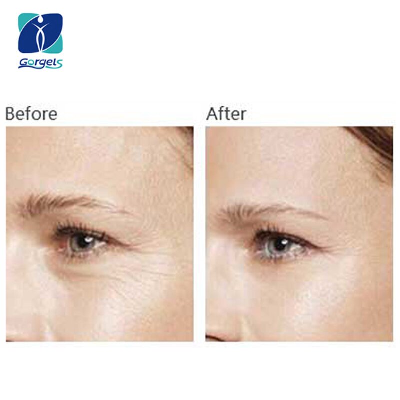 Retinaldehyde Supplier - Retinal Vitamin A Aldehyde CAS 116-31-4