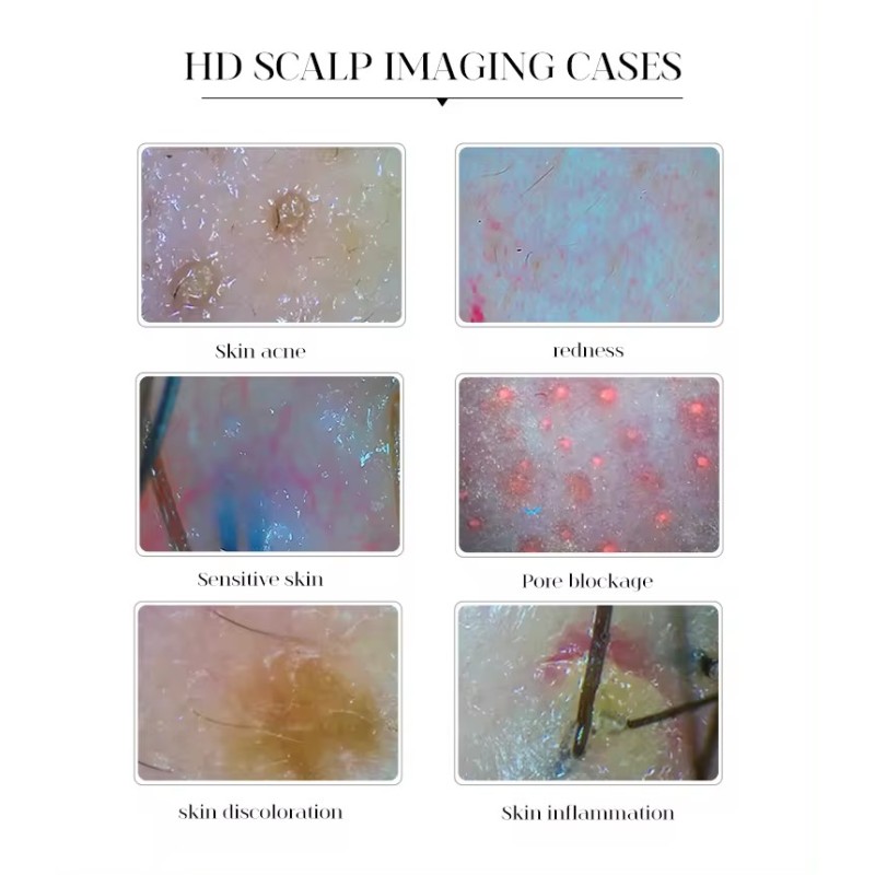 Portable Salon Hair Analyzer/ Hair Scalp Scanner/ Hair Analysis Machine