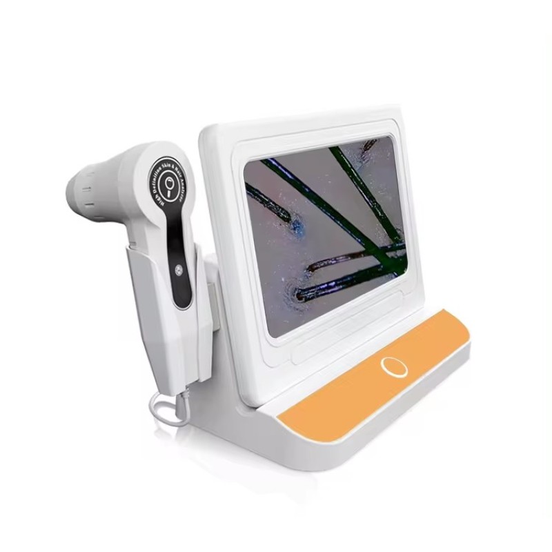 Portable Salon Hair Analyzer/ Hair Scalp Scanner/ Hair Analysis Machine