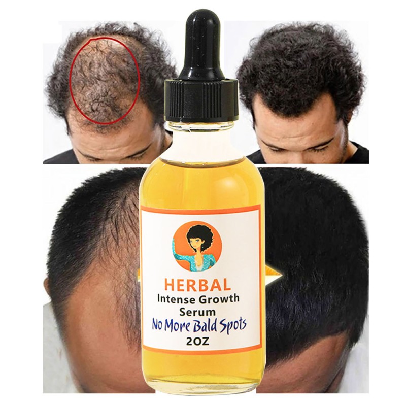 New Arrival Natural Pure Organic Batana Oil Hair Growth Vegan Liquid Form Curly Hair Wholesale Promotes Regrowth Raw Batana Oil