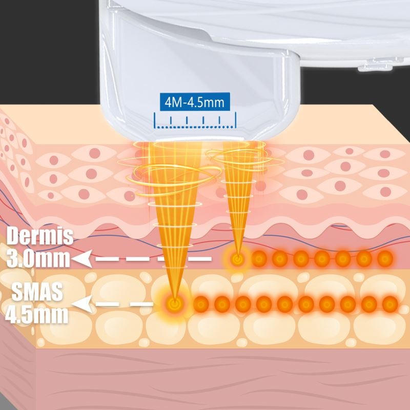 Professional Dual Depth System Anti-Wrink Removal Anti-aging Body Shaping Face Lifting SkinTightening Beauty Salon Equipment